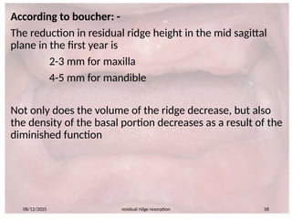 660365804-Residual-ridge-resorption-seminar-PART-2.pptx