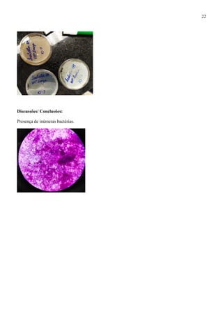 Discussões/ Conclusões:
Presença de inúmeras bactérias.
22
 