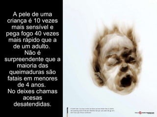 A pele de uma criança é 10 vezes mais sensível e pega fogo 40 vezes mais rápido que a de um adulto.  Não é surpreendente que a maioria das queimaduras são fatais em menores de 4 anos.  No deixes chamas acesas desatendidas. 