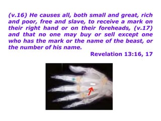 (v.16) He causes all, both small and great, rich and poor, free and slave, to receive a mark on their right hand or on their foreheads, (v.17) and that no one may buy or sell except one who has the mark or the name of the beast, or the number of his name. Revelation 13:16, 17 