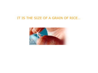 IT IS THE SIZE OF A GRAIN OF RICE… 
