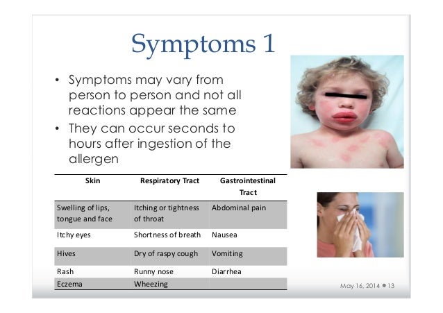 Baby Food Allergy Rash On Belly Baby Food Allergy Rash On Belly