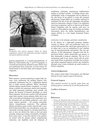 growing appropriately at 5 months post-operatively. A
follow-up catheterisation (Fig 3) and CT-angiogram at
4 months post-operatively disclosed an open inferior caval
vein–pulmonary artery connection, no veno–venous col-
lateral systems in the lower body, and no hepatic venous
congestion.
Discussion
With anatomic concerns pertaining to upper body sys-
temic veins, performing the standard superior cavo-
pulmonary anastomosis may be a challenging forward
step in single ventricle palliation. When considering
optimal staging towards Fontan completion, it is para-
mount to protect the pulmonary arteries from hyperten-
sion while promoting pulmonary artery growth, and
shorten the duration of shunted physiology yet avoid
Glenn takedown. Faced with a patient with sub-optimal
upper body systemic venous anatomy, likely due to vas-
cular access-induced thrombosis of the innominate vein,
we attempted and successfully performed a new alter-
native surgical operation – the primary extracardiac
inferior cavopulmonary connection. This palliation
allowed saturations equal to those expected after a stan-
dard bi-directional Glenn, the post-operative course was
uneventful, of similar duration to a bi-directional Glenn,
and, to date, has allowed the infant to feed and grow
normally, without any evidence of morbidity. If a hepatic
factor entity exists,2
it may ﬂow directly to the pulmon-
ary arteries with the primary inferior cavopulmonary
connection, and hopefully avoid the formation of
troublesome pulmonary arteriovenous malformations
leading to increased cyanosis.3
A bubble-contrast echo-
cardiographic study or angiography will be planned in
the near future of our patient to study this potential
phenomenon. Longer follow-up is certainly warranted to
understand the fate of this new physiology and perhaps
extend its indications: whether it leads to an unplanned
inter-stage re-operation, will be an ideal set-up for future
Fontan completion with the superior caval vein,5
or
results in a ﬁnal palliative stage not needing any further
intervention, given the similar haemodynamics and
oxygen delivery to a very largely fenestrated Fontan
circulation.
Limitations to the technique and future considerations
In the absence of a right-sided pumping chamber,
creating an inferior caval vein–pulmonary artery con-
nection with laminar ﬂow, which goes against gravity, in
an infant who is not yet ambulating or even crawling
may be haemodynamically sub-optimal. The true sig-
niﬁcance of this phenomenon compared with the bi-
directional Glenn, which theoretically uses gravity to
ﬂow downwards is however unknown. The use of an
interposition graft of any nature, which will not grow,
may render future re-operations inevitable due to poten-
tial conduit outgrowth (patient-conduit size mismatch),
although many centres uniformly use small conduits at
Fontan completion.
Acknowledgements
The authors thank Kyle Cunningham and Michael
Schenk for their superb surgical illustration.
Financial Support
This research received no speciﬁc grant from any
funding agency, commercial, or not-for-proﬁt sectors.
Conﬂicts of Interest
None.
References
1. Pridjian AK, Mendelsohn AM, Lupinetti FM, et al. Usefulness of
the bidirectional Glenn procedure as staged reconstruction for the
functional single ventricle. Am J Cardiol 1993; 71: 959–962.
2. Bernstein HS, Brook MM, Silverman NH, Bristow J. Development
of pulmonary arteriovenous ﬁstulae in children after
cavopulmonary shunt. Circulation 1995; 92 (Suppl): II309–II314.
3. Knight WB, Mee RBB. A cure for pulmonary arteriovenous ﬁstulas?
Ann Thorac Surg 1995; 59: 999–1001.
4. Iyer GK, Van Arsdell GS, Dicke FP, McCrindle BW, Coles JG,
Williams WG. Are bilateral superior vena cavae a risk factor for
single ventricle palliation? Ann Thorac Surg 2000; 70: 711–716.
5. Macé L, Dervanian P, Losay J, et al. Bidirectional inferior vena cava-
pulmonary artery shunt. Ann Thorac Surg 1997; 63: 1321–1325.
Figure 3.
Post-operative early injection angiogram showing the inferior
cavopulmonary connection with widely patent anastomoses compatible
with generous pulmonary artery ﬂow.
Dodge-Khatami et al: When the bi-directional Glenn is an unfavourable option 3
 