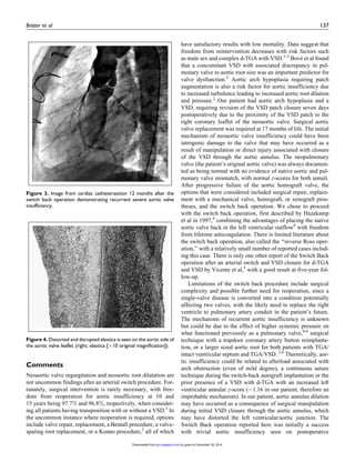 Comments
Neoaortic valve regurgitation and neoaortic root dilatation are
not uncommon findings after an arterial switch procedure. For-
tunately, surgical intervention is rarely necessary, with free-
dom from reoperation for aortic insufficiency at 10 and
15 years being 97.7% and 96.8%, respectively, when consider-
ing all patients having transposition with or without a VSD.3
In
the uncommon instance where reoperation is required, options
include valve repair, replacement, a Bentall procedure, a valve-
sparing root replacement, or a Konno procedure,2
all of which
have satisfactory results with low mortality. Data suggest that
freedom from reintervention decreases with risk factors such
as male sex and complex d-TGA with VSD.1-2
Bove´ et al found
that a concomitant VSD with associated discrepancy in pul-
monary valve to aortic root size was an important predictor for
valve dysfunction.2
Aortic arch hypoplasia requiring patch
augmentation is also a risk factor for aortic insufficiency due
to increased turbulence leading to increased aortic root dilation
and pressure.2
Our patient had aortic arch hypoplasia and a
VSD, requiring revision of the VSD patch closure seven days
postoperatively due to the proximity of the VSD patch to the
right coronary leaflet of the neoaortic valve. Surgical aortic
valve replacement was required at 17 months of life. The initial
mechanism of neoaortic valve insufficiency could have been
iatrogenic damage to the valve that may have occurred as a
result of manipulation or direct injury associated with closure
of the VSD through the aortic annulus. The neopulmonary
valve (the patient’s original aortic valve) was always documen-
ted as being normal with no evidence of native aortic and pul-
monary valve mismatch, with normal z-scores for both annuli.
After progressive failure of the aortic homograft valve, the
options that were considered included surgical repair, replace-
ment with a mechanical valve, homograft, or xenograft pros-
theses, and the switch back operation. We chose to proceed
with the switch back operation, first described by Hazekamp
et al in 1997,4
combining the advantages of placing the native
aortic valve back in the left ventricular outflow4
with freedom
from lifetime anticoagulation. There is limited literature about
the switch back operation, also called the ‘‘reverse Ross oper-
ation,’’ with a relatively small number of reported cases includ-
ing this case. There is only one other report of the Switch Back
operation after an arterial switch and VSD closure for d-TGA
and VSD by Vicente et al,5
with a good result at five-year fol-
low-up.
Limitations of the switch back procedure include surgical
complexity and possible further need for reoperation, since a
single-valve disease is converted into a condition potentially
affecting two valves, with the likely need to replace the right
ventricle to pulmonary artery conduit in the patient’s future.
The mechanism of recurrent aortic insufficiency is unknown
but could be due to the effect of higher systemic pressure on
what functioned previously as a pulmonary valve,4,6
surgical
technique with a trapdoor coronary artery button reimplanta-
tion, or a larger sized aortic root for both patients with TGA/
intact ventricular septum and TGA/VSD .2,6
Theoretically, aor-
tic insufficiency could be related to afterload associated with
arch obstruction (even of mild degree), a continuous suture
technique during the switch-back autograft implantation or the
prior presence of a VSD with d-TGA with an increased left
ventricular annular z-score (À1.16 in our patient, therefore an
improbable mechanism). In our patient, aortic annulus dilation
may have occurred as a consequence of surgical manipulation
during initial VSD closure through the aortic annulus, which
may have distorted the left ventricular/aortic junction. The
Switch Back operation reported here was initially a success
with trivial aortic insufficiency seen on postoperative
Figure 3. Image from cardiac catheterization 12 months after the
switch back operation demonstrating recurrent severe aortic valve
insufficiency.
Figure 4. Distorted and disrupted elastica is seen on the aortic side of
the aortic valve leaflet (right; elastica [Â10 original magnification]).
Brister et al 137
by guest on December 30, 2014pch.sagepub.comDownloaded from
 