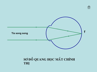 SÔ ÑOÀ QUANG HOÏC MAÉT CHÍNH
THÒ
fTia song song
 