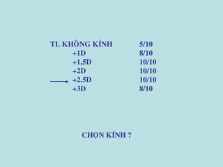 TL KHOÂNG KÍNH 5/10
+1D 8/10
+1,5D 10/10
+2D 10/10
+2,5D 10/10
+3D 8/10
CHOÏN KÍNH ?
 