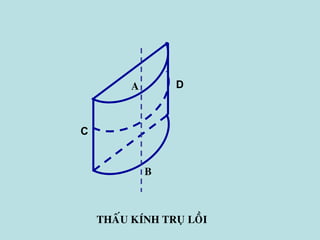 THAÁU KÍNH TRUÏ LOÀI
A
B
C
D
 