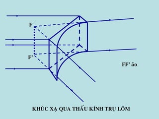 F’
F
KHUÙC XAÏ QUA THAÁU KÍNH TRUÏ LOÕM
FF’ aûo
 