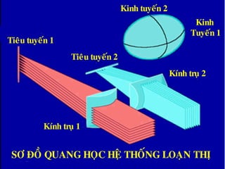 SÔ ÑOÀ QUANG HOÏC HEÄ THOÁNG LOAÏN THÒ
Kính truï 1
Tieâu tuyeán 1
Tieâu tuyeán 2
Kính truï 2
Kinh
Tuyeán 1
Kinh tuyeán 2
 