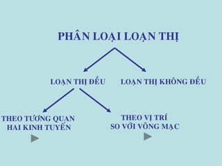 PHAÂN LOAÏI LOAÏN THÒ
LOAÏN THÒ ÑEÀU LOAÏN THÒ KHOÂNG ÑEÀU
THEO TÖÔNG QUAN
HAI KINH TUYEÁN
THEO VÒ TRÍ
SO VÔÙI VOÕNG MAÏC
 