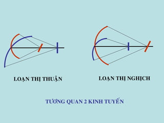 LOAÏN THÒ THUAÄN LOAÏN THÒ NGHÒCH
TÖÔNG QUAN 2 KINH TUYEÁN
 
