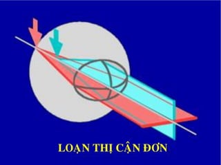 LOAÏN THÒ CAÄN ÑÔN
 