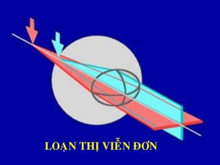 LOAÏN THÒ VIEÃN ÑÔN
 