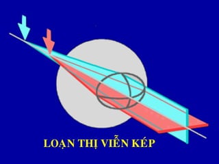 LOAÏN THÒ VIEÃN KEÙP
 