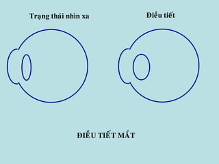 Traïng thaùi nhìn xa Ñieàu tieát
ÑIEÀU TIEÁT MAÉT
 