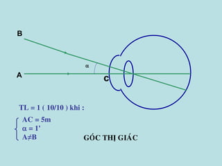 
A
B
GOÙC THÒ GIAÙC
TL = 1 ( 10/10 ) khi :
c
AC = 5m
 = 1'
A≠B
 