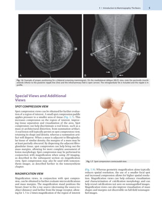 Compression Mammogram Breast Imaging: The Core Requisites 4th Edition Bonnie N. Joe | PDF