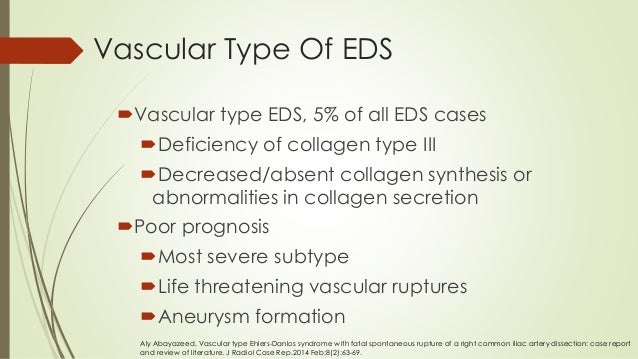 Ehlers-Danlos syndromes(EDS)