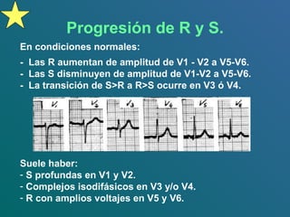 Progresión de R y S.
En condiciones normales:
- Las R aumentan de amplitud de V1 - V2 a V5-V6.
- Las S disminuyen de amplitud de V1-V2 a V5-V6.
- La transición de S>R a R>S ocurre en V3 ó V4.
Suele haber:
- S profundas en V1 y V2.
- Complejos isodifásicos en V3 y/o V4.
- R con amplios voltajes en V5 y V6.
 