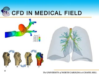 The UNIVERSITY of NORTH CAROLINA at CHAPEL HILL
CFD IN MEDICAL FIELD
4
 