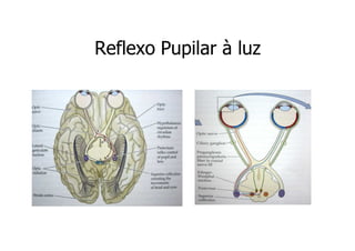 Reflexo Pupilar à luz

 