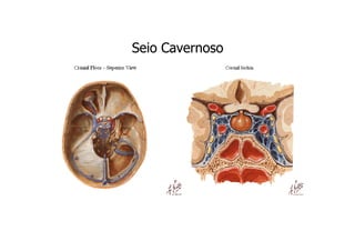 Seio Cavernoso

 