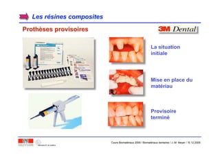 Les rLes réésines compositessines composites
ProthProthèèses provisoiresses provisoires
La situation
initiale
Mise en place du
matériau
Provisoire
terminé
Cours Biomatériaux 2006 / Biomatériaux dentaires / J.-M. Meyer / 15.12.2006
 