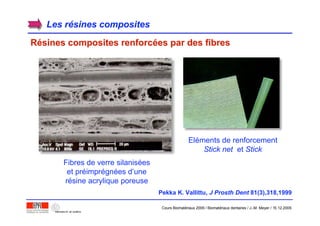 Les rLes réésines compositessines composites
RRéésines composites renforcsines composites renforcéées par des fibreses par des fibres
Fibres de verre silanisées
et préimprégnées d’une
résine acrylique poreuse
Eléments de renforcement
Stick net et Stick
Pekka K. Vallittu, J Prosth Dent 81(3),318,1999
Cours Biomatériaux 2006 / Biomatériaux dentaires / J.-M. Meyer / 15.12.2006
 