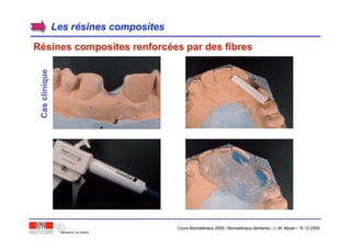 Les rLes réésines compositessines composites
RRéésines composites renforcsines composites renforcéées par des fibreses par des fibresCasclinique
Cours Biomatériaux 2006 / Biomatériaux dentaires / J.-M. Meyer / 15.12.2006
 