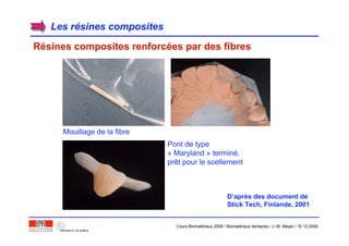 Les rLes réésines compositessines composites
RRéésines composites renforcsines composites renforcéées par des fibreses par des fibres
Mouillage de la fibre
D’après des document de
Stick Tech, Finlande, 2001
Pont de type
« Maryland » terminé,
prêt pour le scellement
Cours Biomatériaux 2006 / Biomatériaux dentaires / J.-M. Meyer / 15.12.2006
 