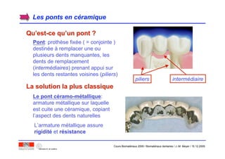 Les ponts en cLes ponts en cééramiqueramique
QuQu’’est-ce quest-ce qu’’un pont ?un pont ?
La solution la plus classiqueLa solution la plus classique
Le pontLe pont ccééramoramo-m-méétalliquetallique:
armature métallique sur laquelle
est cuite une céramique, copiant
l’aspect des dents naturelles
PontPont: prothèse fixée ( = conjointe )
destinée à remplacer une ou
plusieurs dents manquantes, les
dents de remplacement
(intermédiaires) prenant appui sur
les dents restantes voisines (piliers)
L’armature métallique assure
rigiditrigiditéé et rréésistancesistance
piliers intermédiaire
Cours Biomatériaux 2006 / Biomatériaux dentaires / J.-M. Meyer / 15.12.2006
 