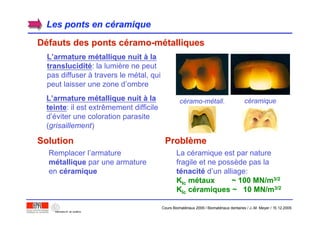 Les ponts en cLes ponts en cééramiqueramique
DDééfauts des pontsfauts des ponts ccééramoramo-m-méétalliquestalliques
LL’’armature marmature méétallique nuittallique nuit àà lala
translucidittransluciditéé: la lumière ne peut
pas diffuser à travers le métal, qui
peut laisser une zone d’ombre
LL’’armature marmature méétallique nuittallique nuit àà lala
teinteteinte: il est extrêmement difficile
d’éviter une coloration parasite
(grisaillement)
Remplacer l’armature
mméétalliquetallique par une armature
en ccééramiqueramique
SolutionSolution
La céramique est par nature
fragile et ne possède pas la
ttéénacitnacitéé d’un alliage:
KKIcIc mméétaux ~ 100 MN/mtaux ~ 100 MN/m3/23/2
KKIcIc ccééramiques ~ 10 MN/mramiques ~ 10 MN/m3/23/2
ProblProblèèmeme
céramo-métall. céramique
Cours Biomatériaux 2006 / Biomatériaux dentaires / J.-M. Meyer / 15.12.2006
 
