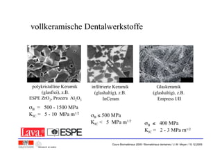10 m2 m10 m
infiltrierte Keramik
(glashaltig), z.B.
InCeram
polykristalline Keramik
(glasfrei), z.B.
ESPE ZrO2, Procera Al2O3
= 500 - 1500 MPa
KIC = 5 - 10 MPa m1/2
B 500 MPa
KIC < 5 MPa m1/2
B 400 MPa
KIC = 2 - 3 MPa m1/2
Glaskeramik
(glashaltig), z.B.
Empress I/II
vollkeramische Dentalwerkstoffevollkeramische Dentalwerkstoffe
Cours Biomatériaux 2006 / Biomatériaux dentaires / J.-M. Meyer / 15.12.2006
 
