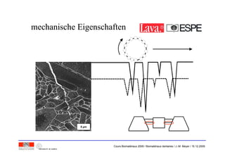 a
5 m
mechanische Eigenschaftenmechanische Eigenschaften
Cours Biomatériaux 2006 / Biomatériaux dentaires / J.-M. Meyer / 15.12.2006
 