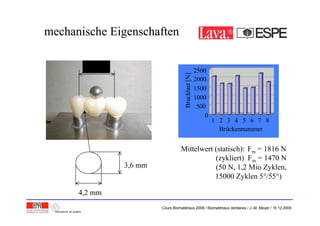 mechanische Eigenschaftenmechanische Eigenschaften
20 mm
3,6 mm
4,2 mm
Mittelwert (statisch): Fm = 1816 N
(zykliert) Fm = 1470 N
(50 N, 1,2 Mio Zyklen,
15000 Zyklen 5°/55°)
0
500
1000
1500
2000
2500
Bruchlast[N]
1 2 3 4 5 6 7 8
Brückennummer
Cours Biomatériaux 2006 / Biomatériaux dentaires / J.-M. Meyer / 15.12.2006
 