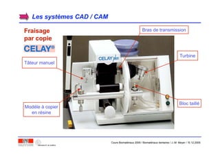 Les systLes systèèmes CAD / CAMmes CAD / CAM
FraisageFraisage
par copiepar copie
Modèle à copier
en résine
Tâteur manuel
Bras de transmission
Turbine
Bloc taillé
Cours Biomatériaux 2006 / Biomatériaux dentaires / J.-M. Meyer / 15.12.2006
 