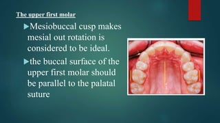 Mesial Rotation Orthodontic finishing proffit chapter17.pptx