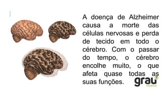 A doença de Alzheimer
causa a morte das
células nervosas e perda
de tecido em todo o
cérebro. Com o passar
do tempo, o cérebro
encolhe muito, o que
afeta quase todas as
suas funções.
 