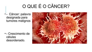 O QUE É O CÂNCER?
• - Câncer: palavra
designada para
tumores malignos
• - Crescimento de
células
desordenado.
 