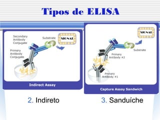 Tipos de ELISA
2. Indireto 3. Sanduíche
 