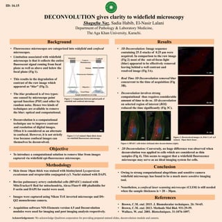 DECONVOLUTION gives clarity to widefield microscopy
Shagufta Naz, Sadia Habib, El-Nasir Lalani
Department of Pathology & Laboratory Medicine,
The Aga Khan University, Karachi.
Background
Objective
Methodology
Results
Conclusion
• To introduce a computational solution to remove blur from images
captured via widefield epi-fluorescence microscope.
• Skin tissue 10μm thick was stained with biotinylated Lycopersicon
esculentum and streptavidin conjugated cy3. Nuclei stained with DAPI.
• Bovine pulmonary artery endothelial cells (BPAEC) stained with
MitoTracker® Red for mitochondria, Alexa Fluor® 488 phalloidin for
F-actin and DAPI for nuclei were used.
• Images were captured using Nikon Ti-E inverted microscope and DS-
Qi2 monochrome camera.
• Acquisition software NIS-Elements version 4.5 and Deconvolution
modules were used for imaging and post imaging analysis respectively.
• Owing to strong computational alogrithms and sensitive camera
widefield microscopy has found to be a much more sensitive imaging
tool.
• Nonetheless, a confocal laser scanning microscope (CLSM) is still needed
when the sample thickness is > 20 – 30μm.
Acknowledgement: We acknowledge Qualitron corporation for providing prepared stained slides, deconvolution module and camera.
• Limitation associated with widefield
microscope is that it collects the entire
fluorescent signal coming from focal
plane as well as above and below the
focal plane (Fig 1).
• This results in the degradation of
contrast of the raw image which
appeared as “blur” (Fig 2).
• The blur produced is of two types:
one caused by microscope point
spread function (PSF) and other by
random noise. Hence two kinds of
techniques are available to remove
the blur: optical and computational.
• Deconvolution is a computational
technique use to improve contrast
and resolution of digital images.
Often it is considered as an alternate
to confocal. However, it is not strictly
true because confocal images can
themselves be deconvolved.
Figure 1. Comparison between optical path of
widefield and confocal microscope.
Figure 2. Cy3 stained 10μm thick tissue
via widefield fluorescence microscopy.
• 3D Deconvolution: Image sequence
containing 25 Z-stacks of 0.25 µm were
acquired. In comparison to the raw image
(Fig 2) most of the out-of-focus light
(blur) appeared to be effectively removed
leaving behind a well contrast and
resolved image (Fig 3A).
• Real Time 3D Deconvolution removed blur
concurrent to the time of acquisition (Fig
3B).
• Deconvolution involves strong
computational thus requires considerable
amount of time to do so. 3D deconvolution
on selected region of interest (ROI)
reduced the time significantly (Fig 3C).
Figure 3. Deconvolved images (A, B & C) of cy3
stained, 10μm thick tissue .
Figure 4. BPAEC cells before (left)and after deconvolution (right).
• 2D Deconvolution: Conversely, no huge difference was observed when
deconvolution was applied to cells which are considered as thin
samples (Fig 4). This seems to suggest that a widefield fluorescence
microscope may serve as an ideal imaging system for cells.
• Fluorescence microscopes are categorized into widefield and confocal
microscopes.
60x
3C, 60x
3A, 60x
3B, 60x
100x
References
• Brown, C.M. etal. 2015. J. Biomolecular techniques. 26: 54-65.
• Brown, C.M. etal. 2013. Methods Mol Biol. 931:29-59.
• Wallace, W. etal. 2001. Biotechniques. 31:1076-1097.
100x
ID: 16.15
Pinhole
Camera /
Photodetector
Widefield Confocal
Objective
Sample mounted on coverslip
Focal Plane
Fluorescence Emission
 