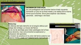 Chevron Invision Incisiones-Quirurgicas-y-Planos-Quirurgicos.pptx