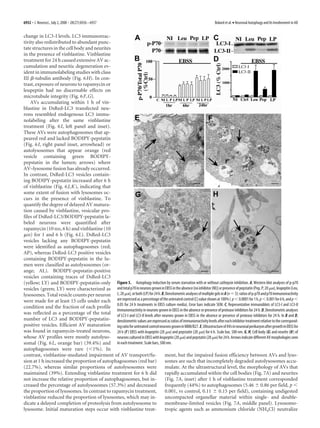 6932 • J. Neurosci., July 2, 2008 • 28(27):6926 – 6937                                                                   Boland et al. • Neuronal Autophagy and Its Involvement in AD


change in LC3-I levels. LC3 immunoreac-
tivity also redistributed to abundant punc-
tate structures in the cell body and neurites
in the presence of vinblastine. Vinblastine
treatment for 24 h caused extensive AV ac-
cumulation and neuritic degeneration ev-
ident in immunolabeling studies with class
III ␤-tubulin antibody (Fig. 6 H). In con-
trast, exposure of neurons to rapamycin or
leupeptin had no discernable effects on
microtubule integrity (Fig. 6 F, G).
    AVs accumulating within 1 h of vin-
blastine in DsRed-LC3 transfected neu-
rons resembled endogenous LC3 immu-
nolabeling after the same vinblastine
treatment (Fig. 6 I, left panel and inset).
These AVs were autophagosomes that ap-
peared red and lacked BODIPY-pepstatin
(Fig. 6 I, right panel inset, arrowhead) or
autolysosomes that appear orange (red
vesicle containing green BODIPY-
pepstatin in the lumen; arrows) where
AV–lysosome fusion has already occurred.
In contrast, DsRed-LC3 vesicles contain-
ing BODIPY-pepstatin increased after 6 h
of vinblastine (Fig. 6 J, K ), indicating that
some extent of fusion with lysosomes oc-
curs in the presence of vinblastine. To
quantify the degree of delayed AV matura-
tion caused by vinblastine, vesicular pro-
files of DsRed-LC3/BODIPY-pepstatin la-
beled neurons were quantified after
rapamycin (10 nM, 6 h) and vinblastine (10
␮M) for 1 and 6 h (Fig. 6 L). DsRed-LC3
vesicles lacking any BODIPY-pepstatin
were identified as autophagosomes (red;
AP), whereas DsRed-LC3 positive vesicles
containing BODIPY-pepstatin in the lu-
men were classified as autolysosomes (or-
ange; AL). BODIPY-pepstatin-positive
vesicles containing traces of DsRed-LC3
(yellow; LY) and BODIPY-pepstatin-only Figure 5. Autophagy induction by serum starvation with or without cathepsin inhibition. A, Western blot analyses of p-p70
vesicles (green; LY) were characterized as and total p70 in neurons grown in EBSS in the absence [no inhibitor (NI)] or presence of pepstatin (Pep, P; 20 ␮M), leupeptin (Leu,
lysosomes. Total vesicle counts per neuron L; 20 ␮M), or both (LP) for 24 h. B, Densitometric analyses of multiple gels in A (n ϭ 5): ratios of p-p70 and p70 immunoreactivity
were made for at least 15 cells under each are expressed as a percentage of the untreated control (C) value shown at 100% ( p Ͻ 0.0001 for 1 h, p Ͻ 0.001 for 6 h, and p Ͻ
condition and the fraction of each profile 0.05 for 24 h treatments in EBSS culture media). Error bars indicate SEM. C, Representative immunoblots of LC3-I and LC3-II
                                               immunoreactivity in neurons grown in EBSS in the absence or presence of protease inhibitors for 24 h. D, Densitometric analyses
was reflected as a percentage of the total of LC3-I and LC3-II levels after neurons grown in EBSS in the absence or presence of protease inhibitors for 24 h. In B and D,
number of LC3 and BODIPY-pepstatin- densitometric values are expressed as ratios of immunoreactivity levels after each inhibitor treatment relative to the correspond-
positive vesicles. Efficient AV maturation ing ratio for untreated control neurons grown in NBM/B27. E, Ultrastructure of AVs in neuronal perikaryon after growth in EBSS for
was found in rapamycin-treated neurons, 24 h (F ) EBSS with leupeptin (20 ␮M) and pepstatin (20 ␮M) for 6 h. Scale bar, 500 nm. G, H, Cell body (G) and neurite (H ) of
whose AV profiles were mostly autolyso- neurons cultured in EBSS with leupeptin (20 ␮M) and pepstatin (20 ␮M) for 24 h. Arrows indicate different AV morphologies seen
somal (Fig. 6 L, orange bar) (39.4%) and in each treatment. Scale bars, 500 nm.
autophagosomes were rare (Ͻ1%). In
contrast, vinblastine-mediated impairment of AV transport/fu-                  ment, but the impaired fusion efficiency between AVs and lyso-
sion at 1 h increased the proportion of autophagosomes (red bar)               somes are such that incompletely degraded autolysosomes accu-
(22.7%), whereas similar proportions of autolysosomes were                     mulate. At the ultrastructural level, the morphology of AVs that
maintained (39%). Extending vinblastine treatment for 6 h did                  rapidly accumulated within the cell bodies (Fig. 7A) and neurites
not increase the relative proportion of autophagosomes, but in-                (Fig. 7A, inset) after 1 h of vinblastine treatment corresponded
creased the percentage of autolysosomes (57.3%) and decreased                  frequently (44%) to autophagosomes (5.46 Ϯ 0.86 per field, p Ͻ
the proportion of lysosomes. In contrast to rapamycin treatment,               0.001, vs control, 0.11 Ϯ 0.15 per field), containing undigested
vinblastine reduced the proportion of lysosomes, which may in-                 uncompacted organellar material within single- and double-
dicate a delayed completion of proteolysis from autolysosome to                membrane-limited vesicles (Fig. 7A, middle panel). Lysosomo-
lysosome. Initial maturation steps occur with vinblastine treat-               tropic agents such as ammonium chloride (NH4Cl) neutralize
 