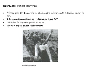 Rigor Mortis (Rigidez cadavérica)
• Começa após 3 to 4 h da morte e atinge o pico máximo em 12 h. Diminui dentro de
48h.
• A deterioração do reticulo sarcoplasmático libera Ca2+
• Estimula a formação de pontes cruzadas
• Não há ATP para causar o relaxamento
Rigidez cadavérica
 