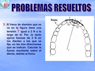 3. El freno de alambre que se
ve en la figura tiene una
tensión T igual a 2 N a lo
largo de él. Por ,lo tanto
ejerce fuerzas de 2 N en
los dientes a los que se
fija, en las dos direcciones
que se indican. Calcular la
fuerza resultante sobre el
diente, debida al freno.
 