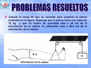 4. Calcule la masa m que se necesita para sostener la pierna
mostrada en la figura. Suponga que la pierna tiene una masa de
12 kg y que su centro de gravedad está a 36 cm de la
articulación de la cadera. El cabestrillo está a 80,5 cm de la
articulación de la cadera.
 