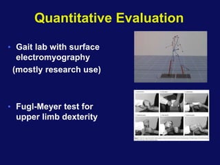 Quantitative Evaluation
• Gait lab with surface
electromyography
(mostly research use)
• Fugl-Meyer test for
upper limb dexterity
 