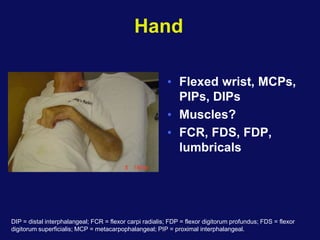Hand
• Flexed wrist, MCPs,
PIPs, DIPs
• Muscles?
• FCR, FDS, FDP,
lumbricals
DIP = distal interphalangeal; FCR = flexor carpi radialis; FDP = flexor digitorum profundus; FDS = flexor
digitorum superficialis; MCP = metacarpophalangeal; PIP = proximal interphalangeal.
 
