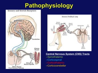 Pathophysiology
Central Nervous System (CNS) Tracts
--Spinothalamic
--Corticospinal
--Corticothalamic
--Corticocerebellar
 