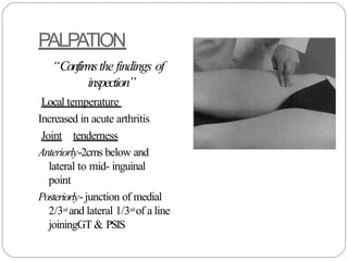 Comprehensive Clinical Hip examination ppt | PPTX